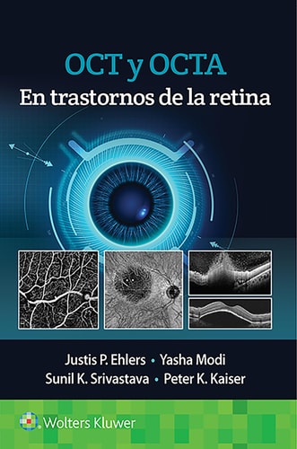 OCT Y OCTA EN TRASTORNOS DE LA RETINA, de EHLERS | portada del libro