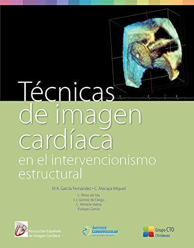 Técnicas de Imagen Cardiaca, de GARCíA FERNANDEZ | portada del libro