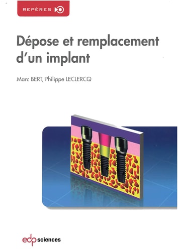 DEPOSE ET REMPLACEMENT D'UN IMPLANT, de Marc Bert | portada del libro