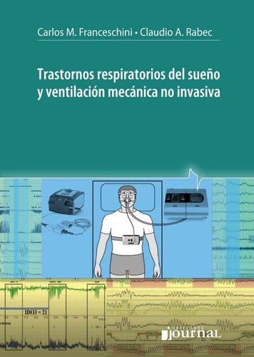 TRASTORNOS RESPIRATORIOS DEL SUEÑO Y VENTILACION MECANICA NO, de FRANCESCHINI | portada del libro