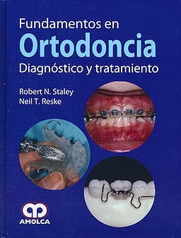 FUNDAMENTOS EN ORTODONCIA. DIAGNOSTICO Y TRATAMIENTO, de ROBERT N. STALEY | portada del libro