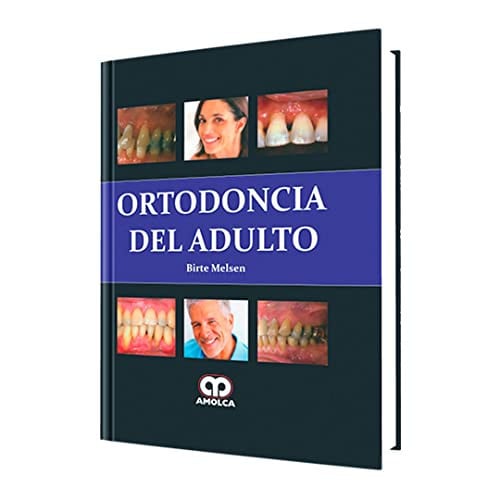 ORTODONCIA DEL ADULTO | portada del libro