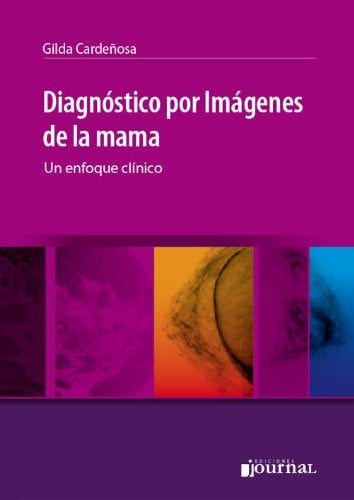 DIAGNOSTICO POR IMAGENES DE LA MAMA UN ENFOQUE CLINICO, de CARDEÑOSA | portada del libro