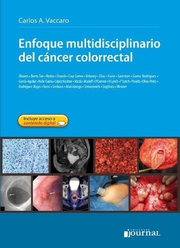 ENFOQUE MULTIDISCIPLINARIO DEL CANCER COLORRECTAL, de VACCARO | portada del libro