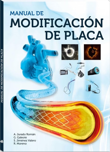 MANUAL DE MODIFICACION DE PLACA, de JURADO ROMAN | portada del libro