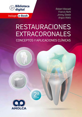 WASSELL RESTAURACIONES EXTRACORONALES CONCEPTOS Y APLICACI | portada del libro