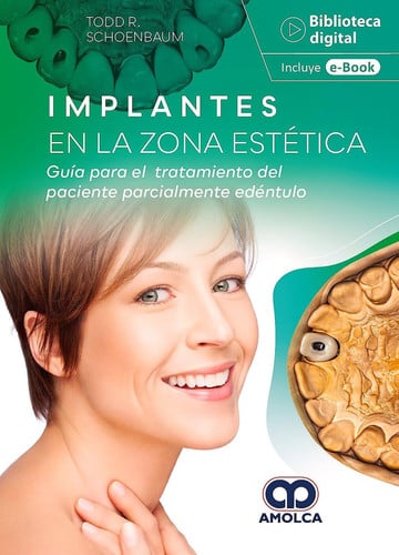 SCHOEMBAUM IMPLANTES EN LA ZONA ESTETICA, de SCHOEMBAUM | portada del libro