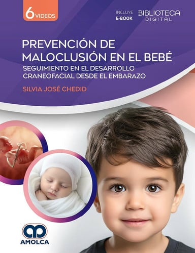 PREVENCION DE MALOCLUSION EN EL BEBE SEGUIMIENTO EN EL DESA, de CHEDID | portada del libro