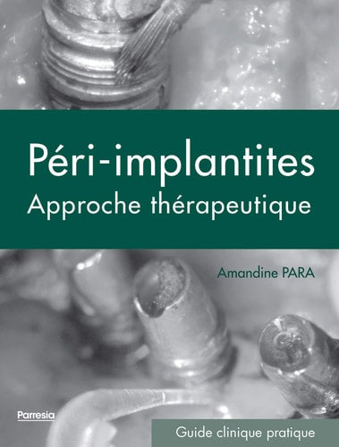PERI-IMPLANTITES LES, de Amandine Para | portada del libro