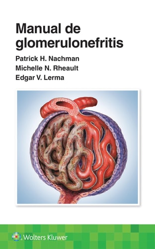 MANUAL DE GLOMERULONEFRITIS, de NACHMAN | portada del libro