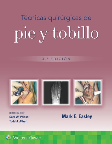 TECNICAS QUIRURGICAS EN PIE Y TOBILLO, de EASLEY | portada del libro
