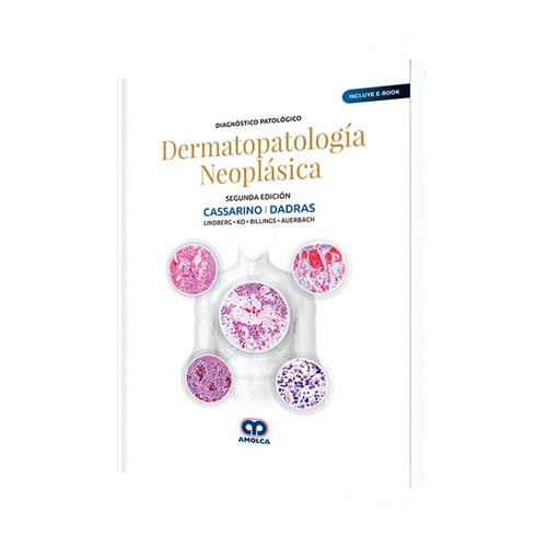 DIAGNOSTICO PATOLOGICO. DERMATOPATOLOGIA NEOPLASICA (INCLUYE E-BO, de CASSARINO | portada del libro