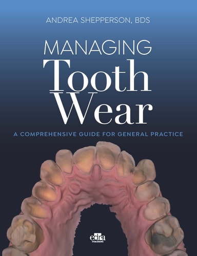 MANAGING TOOTH WEAR, de Andrea Shepperson | portada del libro