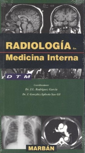 RADIOLOGIA EN MEDICINA INTERNA, de RODRIGUEZ GARCIA | portada del libro
