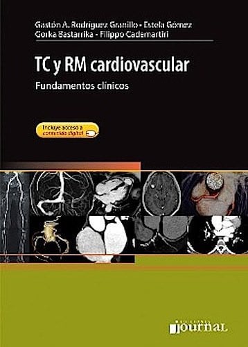 TC Y RM CARDIOVASCULAR FUNDAMENTOS CLINICOS, de RODRIGUEZ | portada del libro