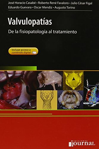 VALVULOPATIAS DE LA FISIOPATOLOGIA AL TRATAMIENTO, de CASABE | portada del libro