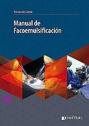 MANUAL DE FACOEMULSIFICACION, de CARIDE | portada del libro