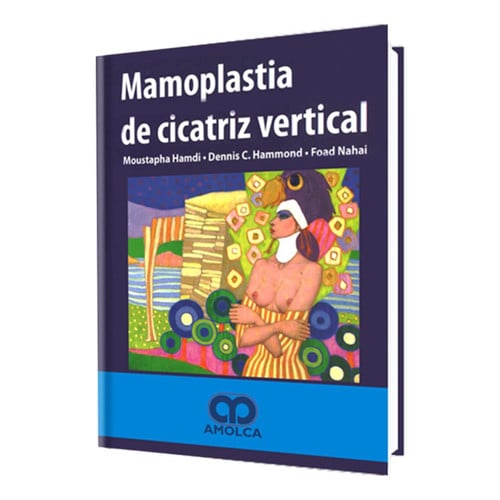 HAMDI MAMOPLASTIA DE CICATRIZ VERTICAL, de M. HAMDI | portada del libro
