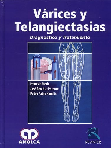 MERLO VARICES Y TELANGIECTASIAS, de I. MERLO | portada del libro
