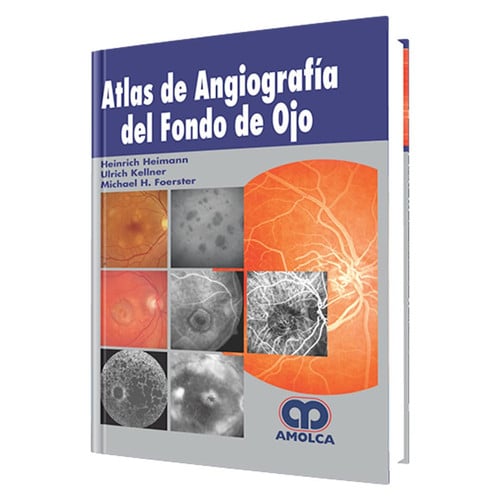 HEIMANN ATLAS ANGIOGRAFIA DEL FONDO DE OJO | portada del libro