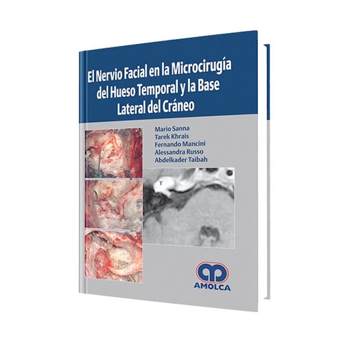 El nervio facial en la microcirugia del hueso temporal y la base lateral del cra, de Varios autores | portada del libro