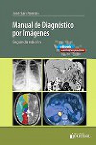 MANUAL DE DIAGNOSTICO POR IMAGENES, de JOSE SAN ROMAN | portada del libro