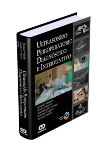 HARMON ULTRASONIDO PERIOPERATORIO, de D. HARMON | portada del libro
