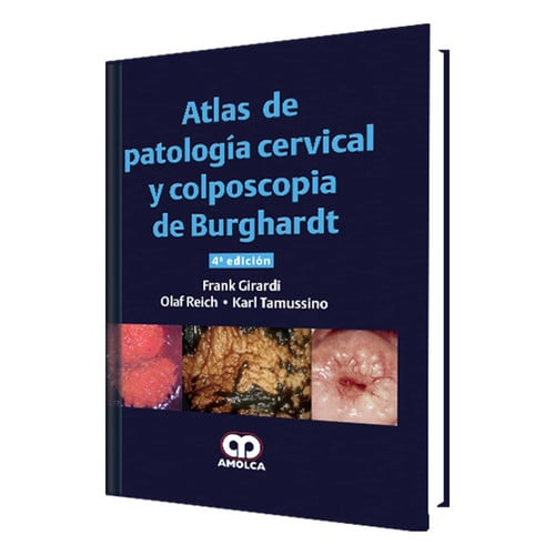 GIRARDI ATLAS PATOLOGIA CERVICAL Y COLPOSCOPIA DE BURGHARD | portada del libro