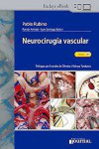 NEUROCIRUGIA VASCULAR, de RUBINO | portada del libro
