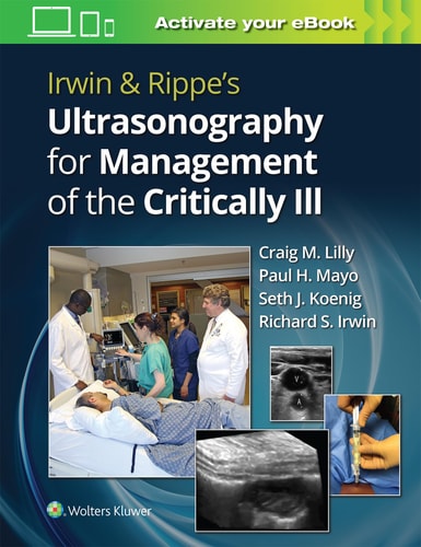 IRWIN, de LILLY | portada del libro