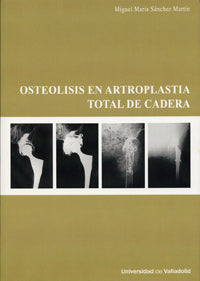 OSTEOLISIS EN ARTROPLASTIA TOTAL DE CADERA, de SANCHEZ MARTIN | portada del libro