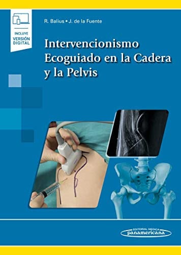 Intervencionismo Ecoguiado en la Cadera y la Pelvis (incluye versión digital), de Balius Matas | portada del libro