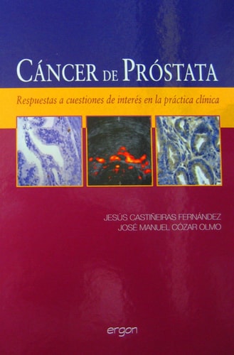 Cáncer de próstata, de CASTIÑEIRA FERNANDEZ | portada del libro