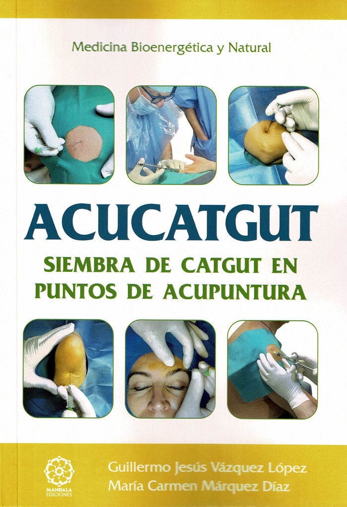 ACUCATGUT. Siembra de Catgut en puntos de acupuntura, de Márquez Díaz, María Carmen | portada del libro