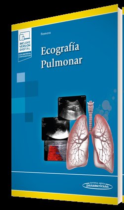 ECOGRAFIA PULMONAR (+ E-BOOK), de ROMERO BERMEJO, FRANCISCO JOSE | portada del libro