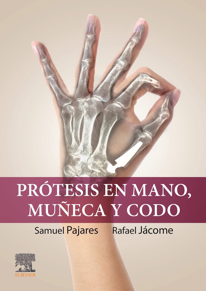 PROTESIS EN MANO MUÑECA Y CODO, de PAJARES,S | portada del libro