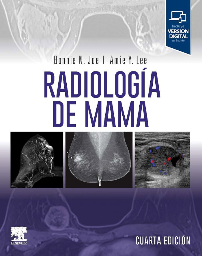 RADIOLOGIA DE MAMA 4ª ED, de JOE | portada del libro