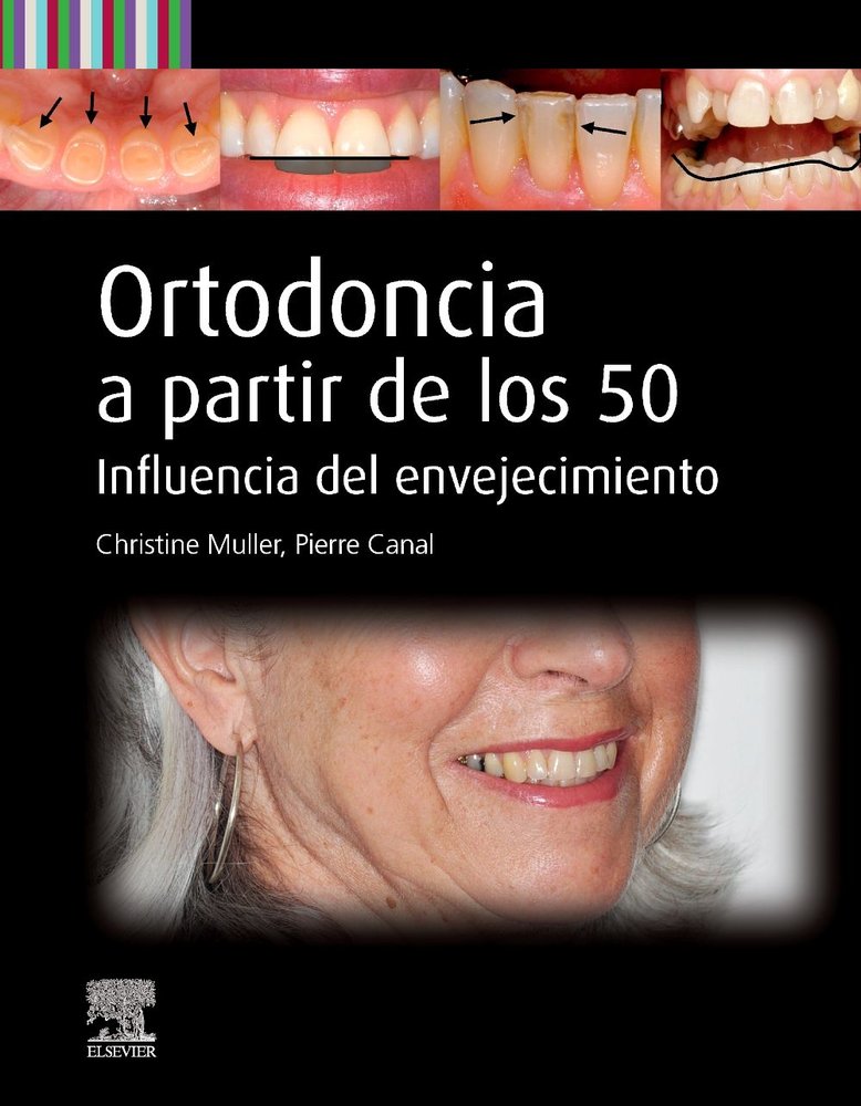 ORTODONCIA A PARTIR DE LOS 50, de MULLER | portada del libro