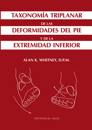 Taxonomía triplanar de las deformidades del pie y de la extremidad inferior, de Whitney, Alan K. | portada del libro