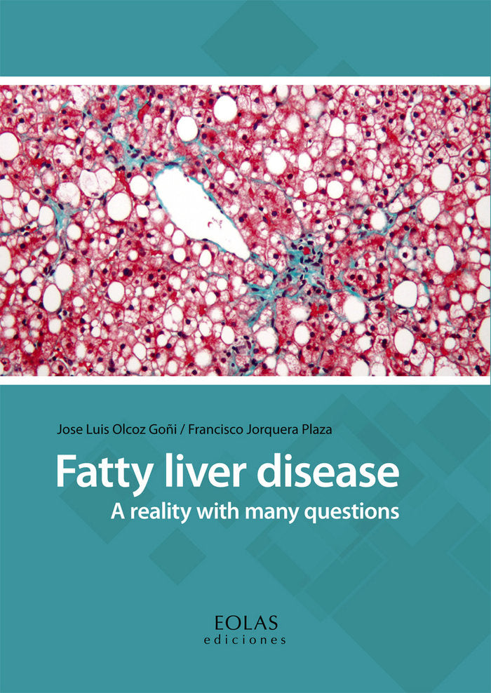 FATTY LIVER DISEASE, de OLCOZ GOÑI, JOSE LUIS | portada del libro
