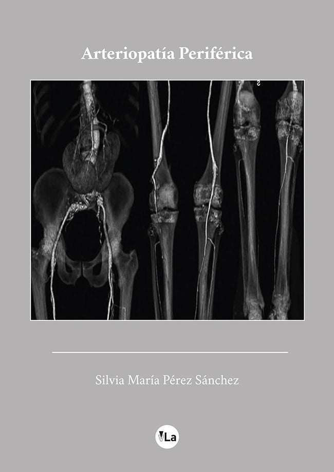 Arteriopatía Periférica, de Pérez Sánchez, Silvia María | portada del libro