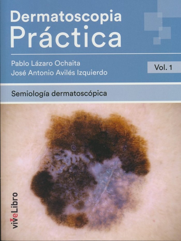 Dermatoscopia Práctica. Vol. 1: Semiología Dermatoscópica, de Lázaro Ochaita | portada del libro