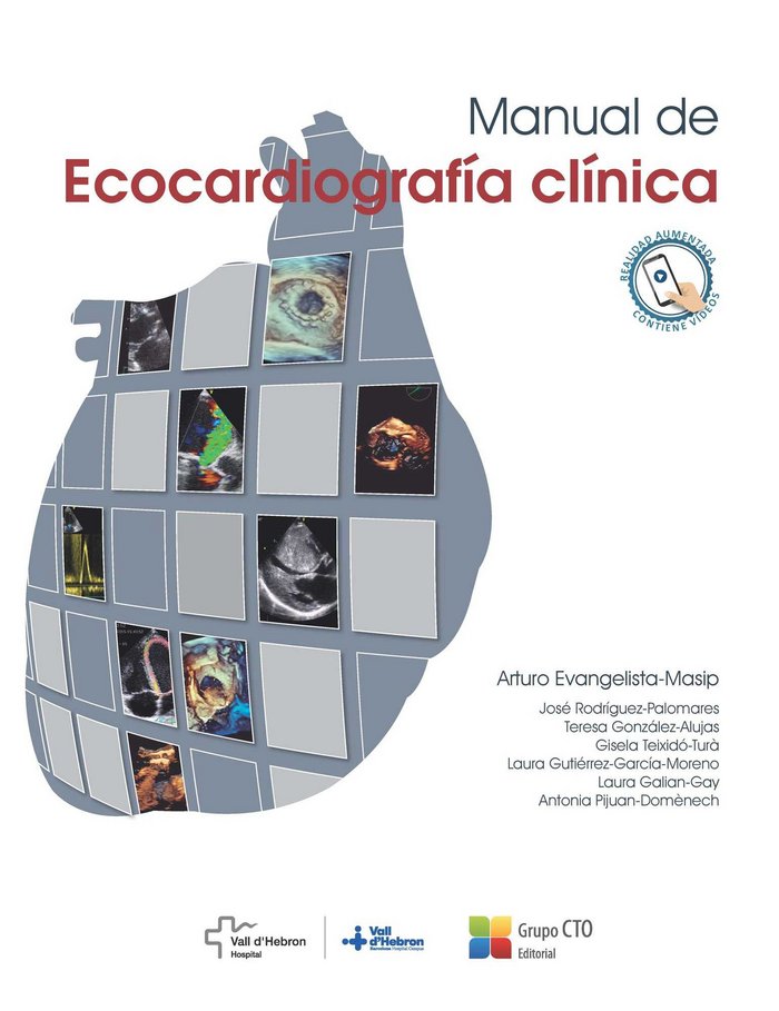 Manual de Ecocardiografía Clínica, de AA.VV. | portada del libro