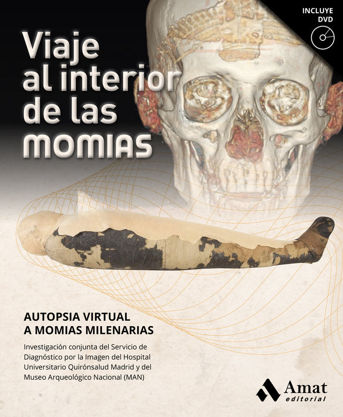 Viaje al interior de las momias, de Servicio de diagnóstico por la Imagen del Hospital Universitario Quirónsalud Madrid | por