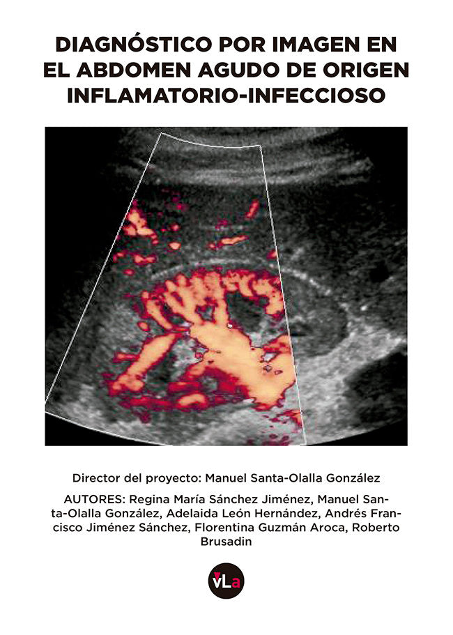 Diagnóstico por imagen en el abdomen agudo de origen inflamatorio-infeccioso, de Sánchez Jiménez, Regina María | portada del