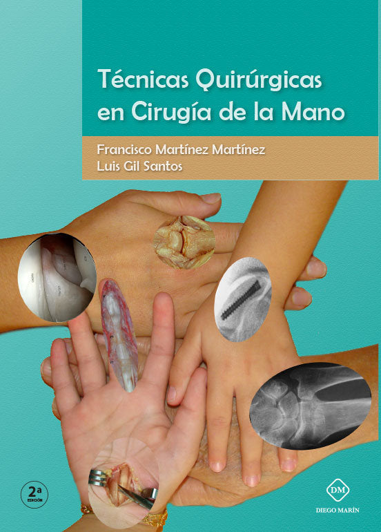TECNICAS QUIRURGICAS EN CIRUGIA DE LA MANO, de MARTINEZ MARTINEZ, FRANCISCO | portada del libro