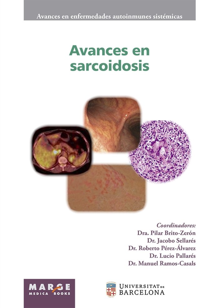 Avances en sarcoidosis, de CERVERA,RICARD | portada del libro