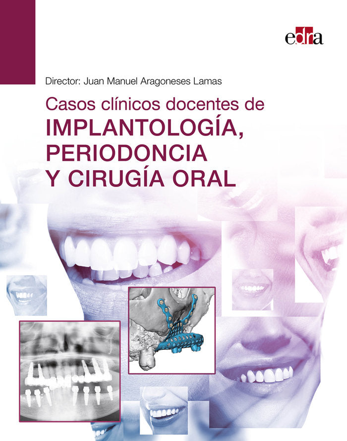 CASOS CLINICOS DOCENTES DE IMPLANTOLOGIA PERIODONCIA Y CIRUGIA OR, de VVAA | portada del libro