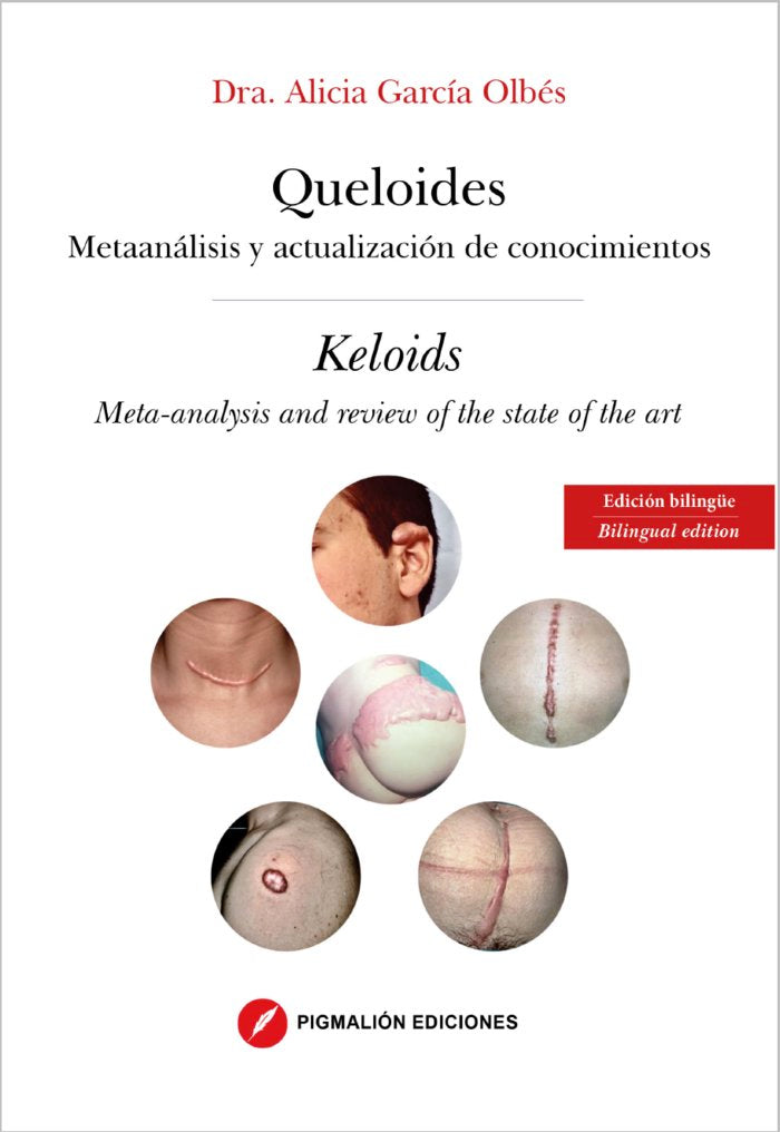 QUELOIDES, de García Olbés, Alicia | portada del libro