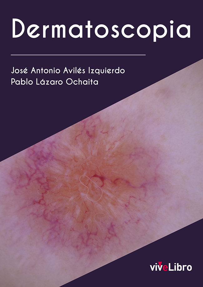Dermatoscopia, de LAZARO OCHAITA, PABLO | portada del libro